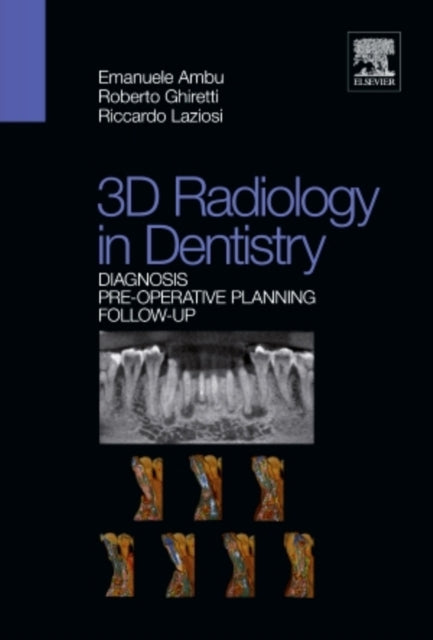 Book cover of: 3D radiology in dentistry - Diagnosis Pre-operative Planning Follow-up. By: Emanuele Ambu