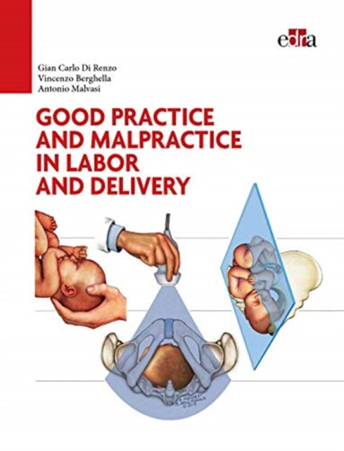 Book cover of: Good Practice and malpractice in labor and delivery. By: Gian Carlo Di Renzo