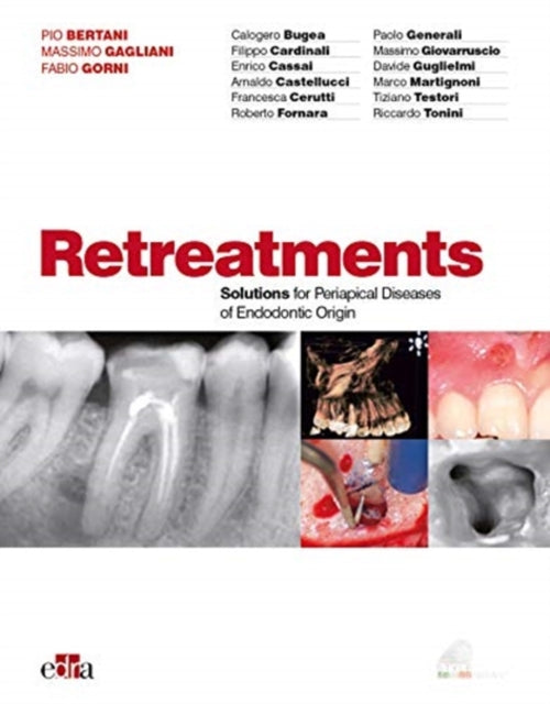 Book cover of: Retreatment. Solutions for apical diseases of endodontic origin. By: Pio Bertani