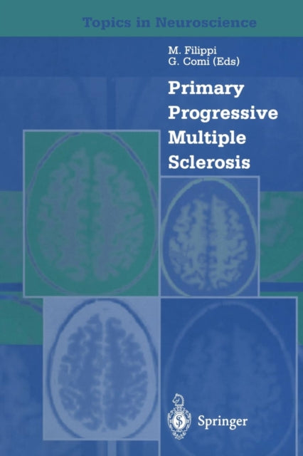 Book cover of: Primary Progressive Multiple Sclerosis. By: M. Filippi