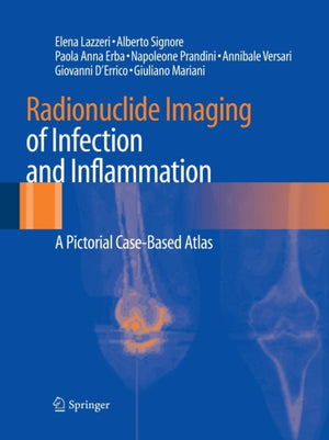 Radionuclide Imaging of Infection and Inflammation