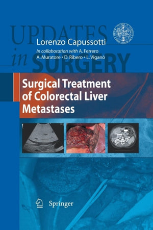 Surgical Treatment of Colorectal Liver Metastases