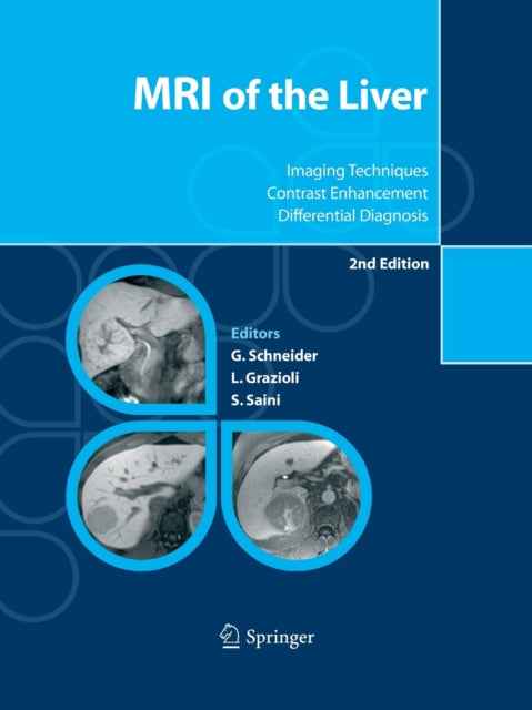 Book cover of: MRI of the Liver. By: Günther Schneider