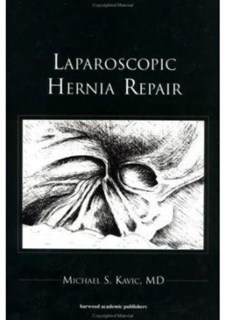 Book cover of: Laparoscopic Hernia Repair. By: Michael S Kavic