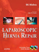 Book cover of: Laparoscopic Hernia Repair. By: R. K. Mishra