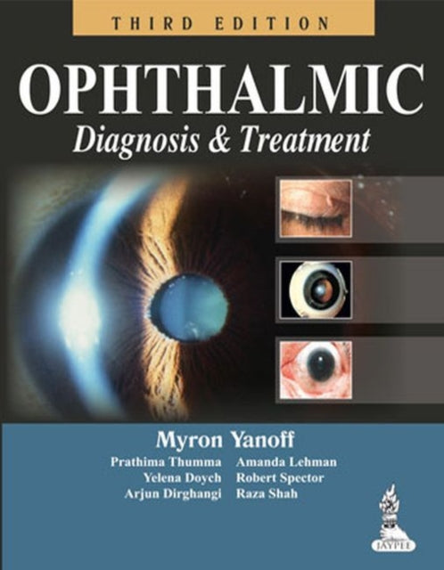 Book cover of: Ophthalmic Diagnosis & Treatment. By: Myron Yanoff
