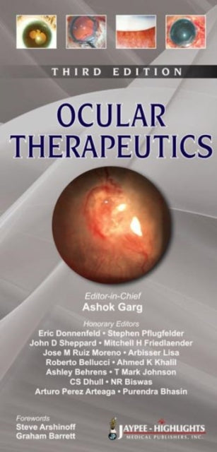 Book cover of: Ocular Therapeutics. By: Ashok Garg