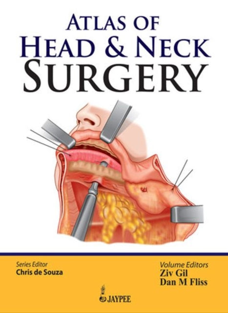 Book cover of: Atlas of Head & Neck Surgery. By: Chris de Souza