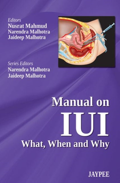 Book cover of: Manual on IUI: What, When and Why