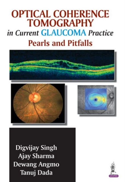 Book cover of: Optical Coherence Tomography in Current Glaucoma Practice. By: Digvijay Singh