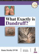 Book cover of: What Exactly is Dandruff?. By: Rama Murthy DVSB