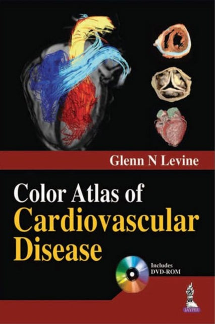 Book cover of: Color Atlas of Cardiovascular Disease. By: Levine