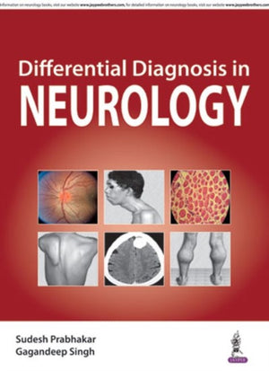 Differential Diagnosis in Neurology