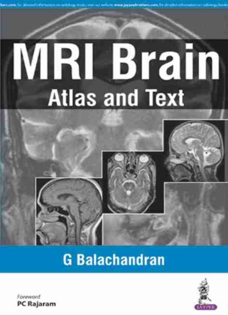 Book cover of: MRI Brain. By: Balachandran, G.