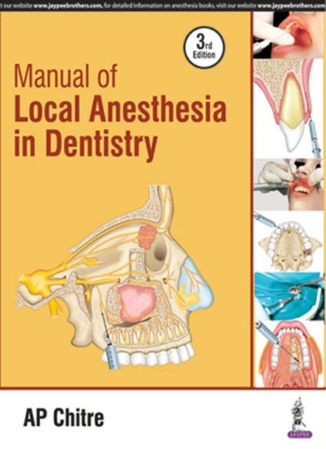 Book cover of: Manual of Local Anaesthesia in Dentistry. By: A. P. Chitre