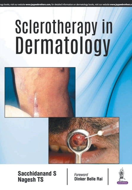 Book cover of: Sclerotherapy in Dermatology. By: Sacchidanand S