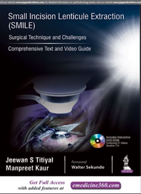 Book cover of: Small Incision Lenticule Extraction (SMILE): Surgical Technique and Challenges. By: Jeewan S. Titiyal