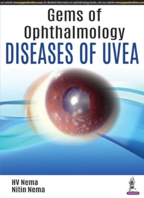 Book cover of: Gems of Ophthalmology: Diseases of Uvea. By: H. V. Nema