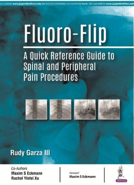 Book cover of: Fluoro-Flip. By: GARZA