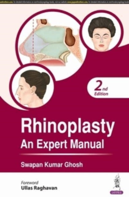 Book cover of: Rhinoplasty. By: Swapan Kumar Ghosh