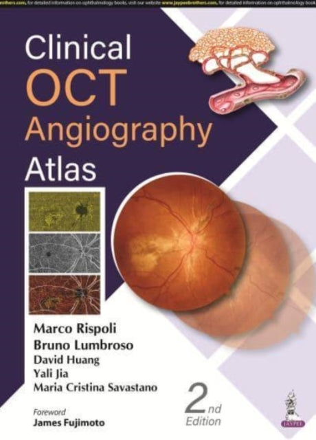 Book cover of: Clinical OCT Angiography Atlas. By: Marco Rispoli