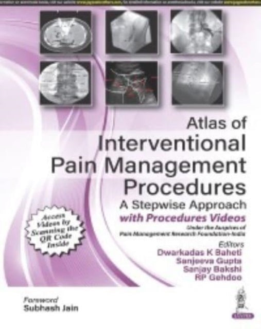 Book cover of: Atlas of Interventional Pain Management Procedures. By: Dwarkadas K. Baheti