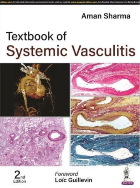 Book cover of: Textbook of Systemic Vasculitis. By: SHARMA