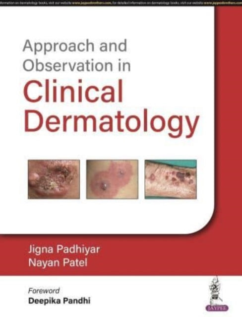 Book cover of: Approach and Observation in Clinical Dermatology. By: Jigna Padhiyar