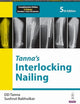 Book cover of: Tanna’s Interlocking Nailing. By: Sushrut Babhulkar