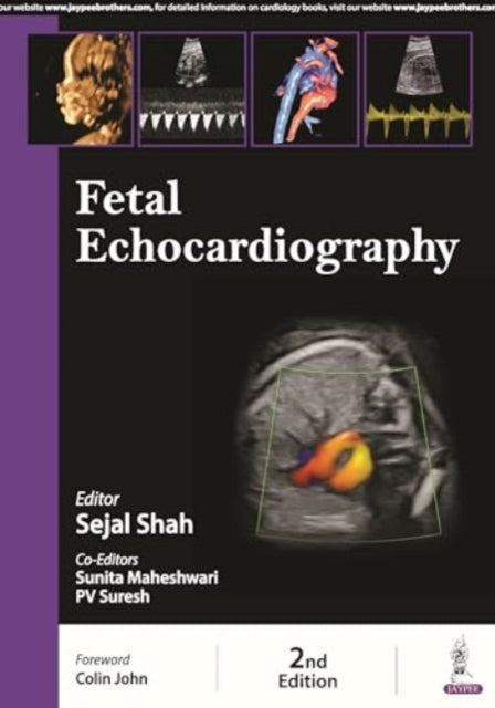 Book cover of: Fetal Echocardiography. By: Maheshwari SHAH