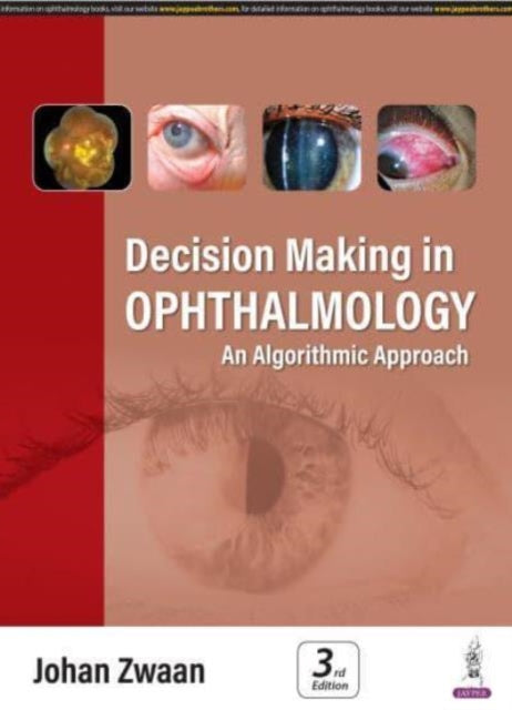 Book cover of: Decision Making in Ophthalmology. By: Johan Zwaan