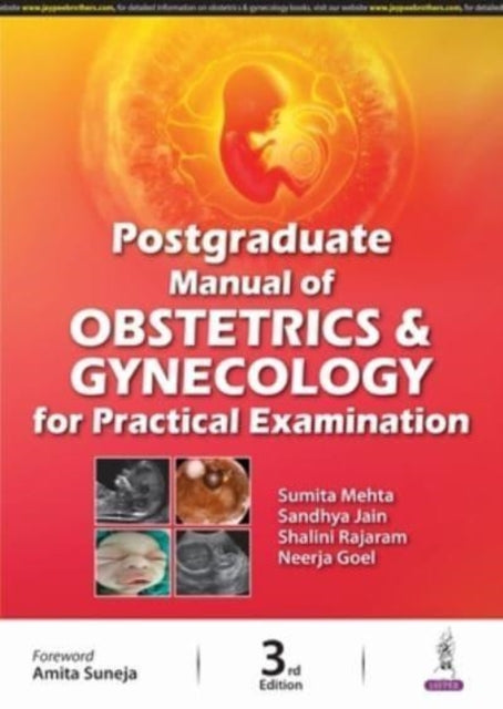Book cover of: Postgraduate Manual of Obstetrics and Gynecology for Practical Examination