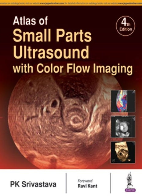 Book cover of: Atlas of Small Parts Ultrasound