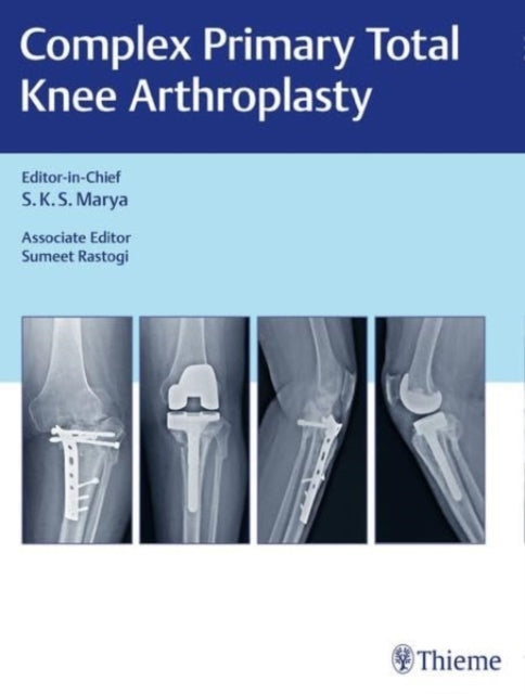 Book cover of: Complex Primary Total Knee Arthroplasty