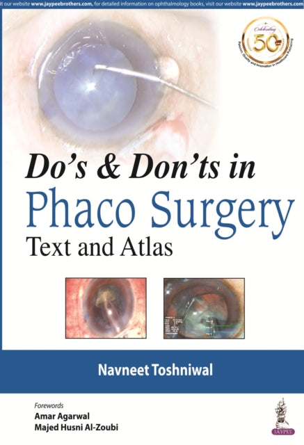 Book cover of: Do's & Dont's in Phaco Surgery. By: Navneet Toshniwal