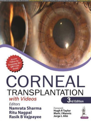 Corneal Transplantation