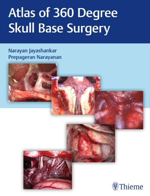 Book cover of: Atlas of 360 Degree Skull Base Surgery. By: Narayan Jayashankar