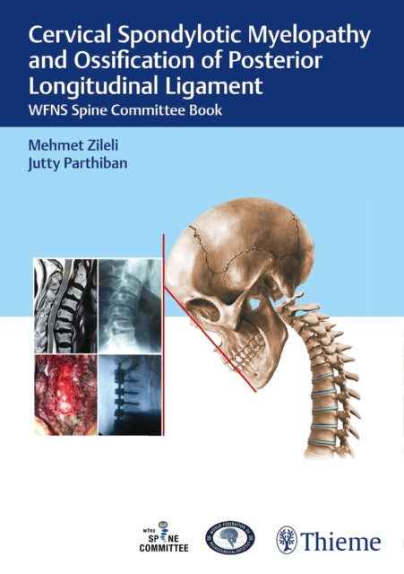 Book cover of: Cervical Spondylotic Myelopathy and Ossification of Posterior Longitudinal Ligament. By: Mehmet Zileli