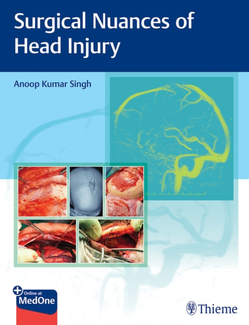 Book cover of: Surgical Nuances of Head Injury. By: Anoop Singh