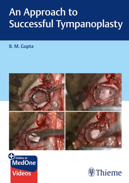Book cover of: Approach to Successful Tympanoplasty. By: B. Gupta