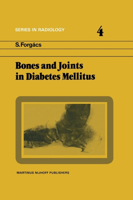 Book cover of: Bones and Joints in Diabetes Mellitus. By: S. Forgács