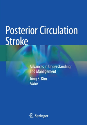 Posterior Circulation Stroke