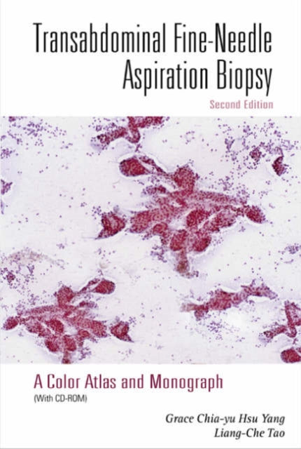 Transabdominal Fine-needle Aspiration Biopsy (2nd Edition)