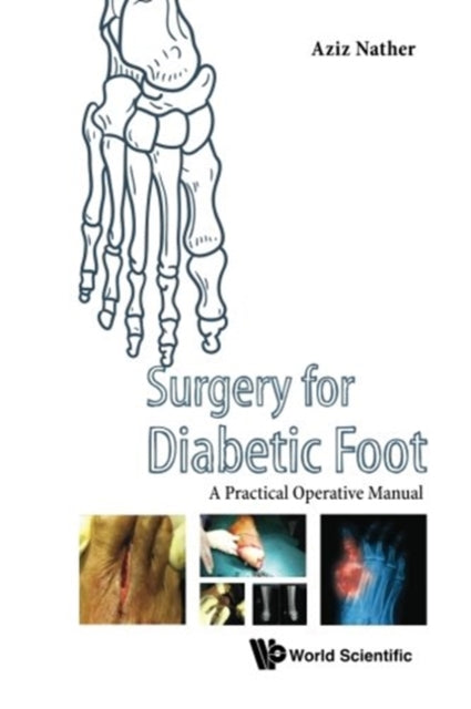 Book cover of: Surgery For Diabetic Foot: A Practical Operative Manual. By: Abdul Aziz Nather