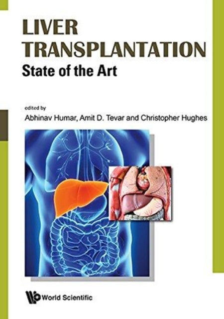 Book cover of: Liver Transplantation: State Of The Art. By: Abhinav Humar