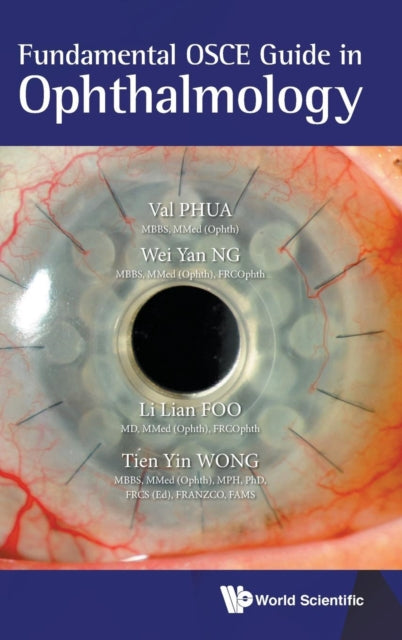 Book cover of: Fundamental Osce Guide In Ophthalmology. By: Val Jun Rong Phua