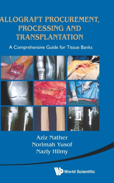 Book cover of: Allograft Procurement, Processing And Transplantation: A Comprehensive Guide For Tissue Banks