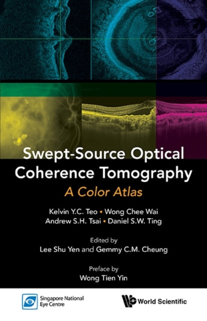 Book cover of: Swept-source Optical Coherence Tomography: A Color Atlas. By: Kelvin Y. C. Teo