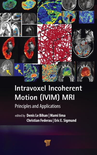 Book cover of: Intravoxel Incoherent Motion (IVIM) MRI. By: Denis Le Bihan