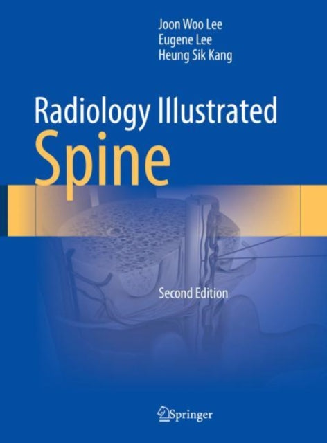 Book cover of: Radiology Illustrated: Spine. By: Joon Woo Lee